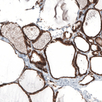Bcl-2 Antibody in Immunohistochemistry (Paraffin) (IHC (P))
