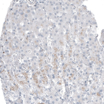 Bcl-2 Antibody in Immunohistochemistry (Paraffin) (IHC (P))