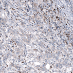 Bcl-2 Antibody in Immunohistochemistry (Paraffin) (IHC (P))