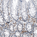 Bcl-2 Antibody in Immunohistochemistry (Paraffin) (IHC (P))