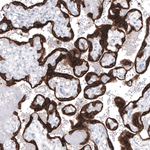 Bcl-2 Antibody in Immunohistochemistry (Paraffin) (IHC (P))