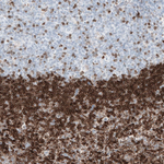 Bcl-2 Antibody in Immunohistochemistry (Paraffin) (IHC (P))