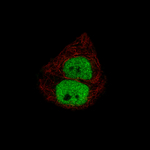 Progesterone Receptor Monoclonal Antibody (CL8721)
