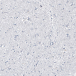 Progesterone Receptor Antibody in Immunohistochemistry (Paraffin) (IHC (P))