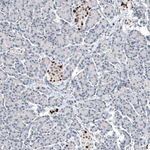 Progesterone Receptor Antibody in Immunohistochemistry (Paraffin) (IHC (P))
