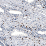 Progesterone Receptor Antibody in Immunohistochemistry (Paraffin) (IHC (P))