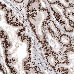 Progesterone Receptor Antibody in Immunohistochemistry (Paraffin) (IHC (P))