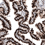 Progesterone Receptor Antibody in Immunohistochemistry (Paraffin) (IHC (P))