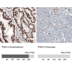 Progesterone Receptor Antibody in Immunohistochemistry (Paraffin) (IHC (P))