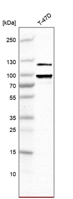Progesterone Receptor Antibody in Western Blot (WB)