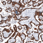 Cytokeratin 7 Antibody in Immunohistochemistry (Paraffin) (IHC (P))