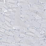 Cytokeratin 7 Antibody in Immunohistochemistry (Paraffin) (IHC (P))