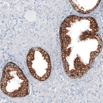 Cytokeratin 7 Antibody in Immunohistochemistry (Paraffin) (IHC (P))