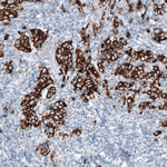 Cytokeratin 7 Antibody in Immunohistochemistry (Paraffin) (IHC (P))