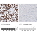 Cytokeratin 7 Monoclonal Antibody (CL8723)