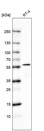 Cytokeratin 7 Antibody in Western Blot (WB)