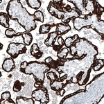 Cytokeratin 7 Antibody in Immunohistochemistry (Paraffin) (IHC (P))