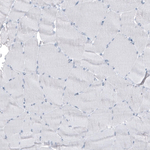 Cytokeratin 7 Antibody in Immunohistochemistry (Paraffin) (IHC (P))