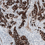 Cytokeratin 7 Antibody in Immunohistochemistry (Paraffin) (IHC (P))