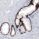 Cytokeratin 7 Antibody in Immunohistochemistry (Paraffin) (IHC (P))
