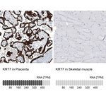 Cytokeratin 7 Antibody in Immunohistochemistry (Paraffin) (IHC (P))