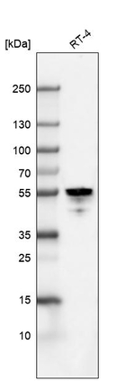 Cytokeratin 7 Antibody in Western Blot (WB)