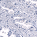 Somatostatin Antibody in Immunohistochemistry (Paraffin) (IHC (P))