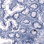 Somatostatin Antibody in Immunohistochemistry (Paraffin) (IHC (P))
