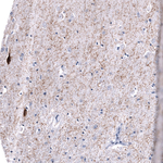 Somatostatin Antibody in Immunohistochemistry (Paraffin) (IHC (P))