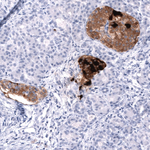 Somatostatin Antibody in Immunohistochemistry (Paraffin) (IHC (P))