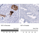 Somatostatin Antibody in Immunohistochemistry (Paraffin) (IHC (P))