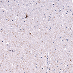 Somatostatin Antibody in Immunohistochemistry (Paraffin) (IHC (P))