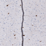 Somatostatin Antibody in Immunohistochemistry (Paraffin) (IHC (P))