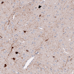 Somatostatin Antibody in Immunohistochemistry (Paraffin) (IHC (P))