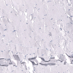 Somatostatin Antibody in Immunohistochemistry (Paraffin) (IHC (P))