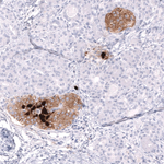Somatostatin Antibody in Immunohistochemistry (Paraffin) (IHC (P))