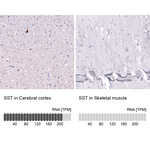 Somatostatin Antibody in Immunohistochemistry (Paraffin) (IHC (P))