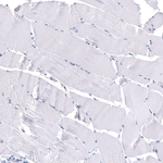 S100A8 Antibody in Immunohistochemistry (Paraffin) (IHC (P))