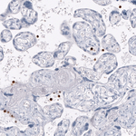 S100A8 Antibody in Immunohistochemistry (Paraffin) (IHC (P))