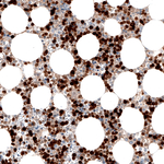 S100A8 Antibody in Immunohistochemistry (Paraffin) (IHC (P))
