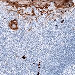 S100A8 Antibody in Immunohistochemistry (Paraffin) (IHC (P))