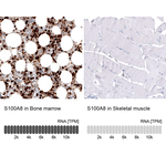 S100A8 Monoclonal Antibody (CL11171)