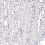 EZH2 Antibody in Immunohistochemistry (Paraffin) (IHC (P))