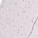 EZH2 Antibody in Immunohistochemistry (Paraffin) (IHC (P))