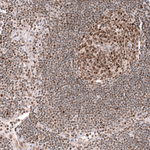 EZH2 Antibody in Immunohistochemistry (Paraffin) (IHC (P))