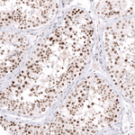 EZH2 Antibody in Immunohistochemistry (Paraffin) (IHC (P))
