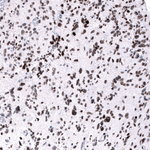 EZH2 Antibody in Immunohistochemistry (Paraffin) (IHC (P))