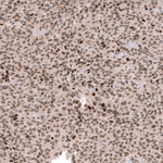 EZH2 Antibody in Immunohistochemistry (Paraffin) (IHC (P))
