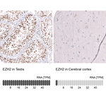 EZH2 Antibody in Immunohistochemistry (Paraffin) (IHC (P))