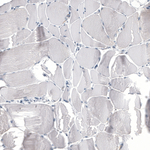 HO-1 Antibody in Immunohistochemistry (Paraffin) (IHC (P))